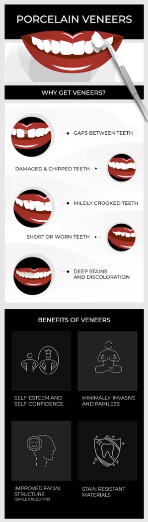 Visual aide for porcelain veneers