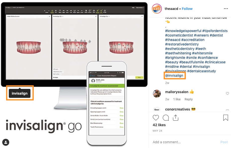 AACD Instagram repost of content from Invisalign