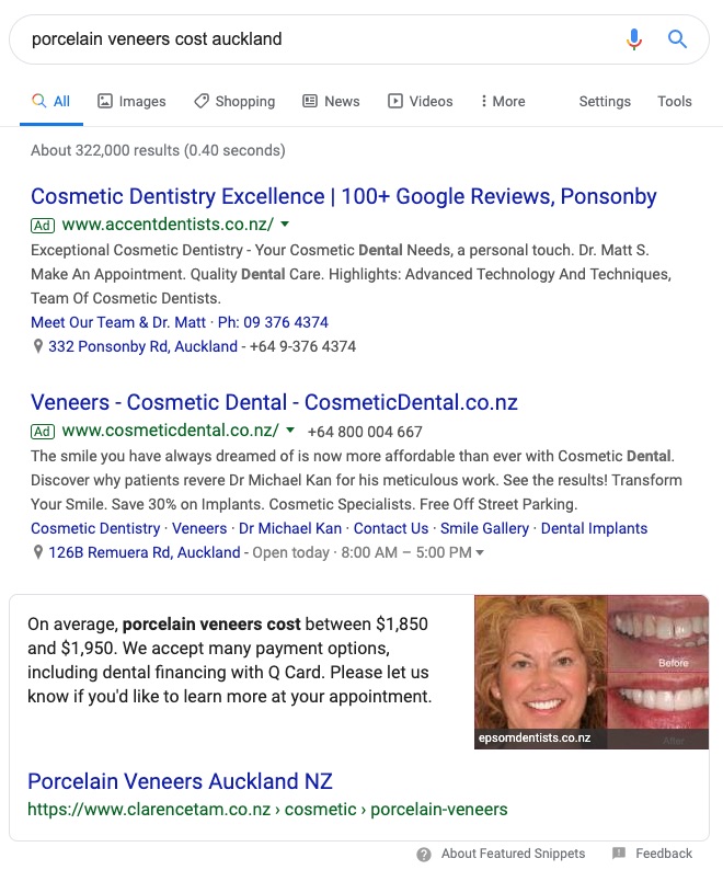Featured Snippet Example 2