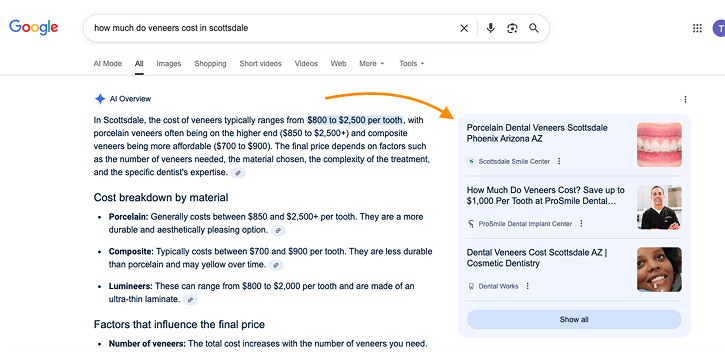 Scottsdale Veneer Cost